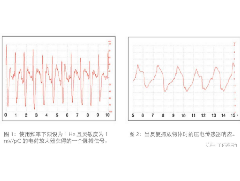 壓電薄膜傳感器在生命特征監測方面應用的解決方案